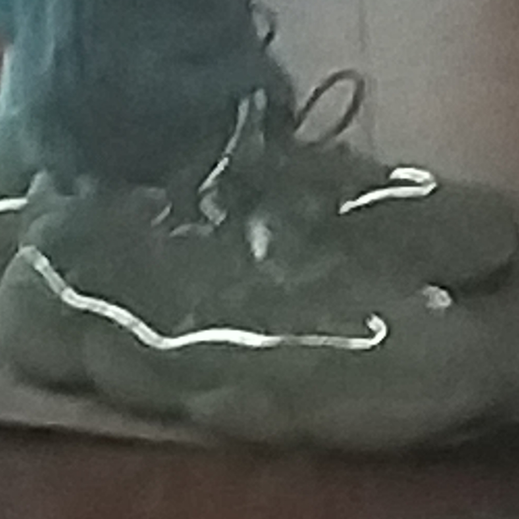 Adidas Yeezy 500 Blush 2018 착용 스타일