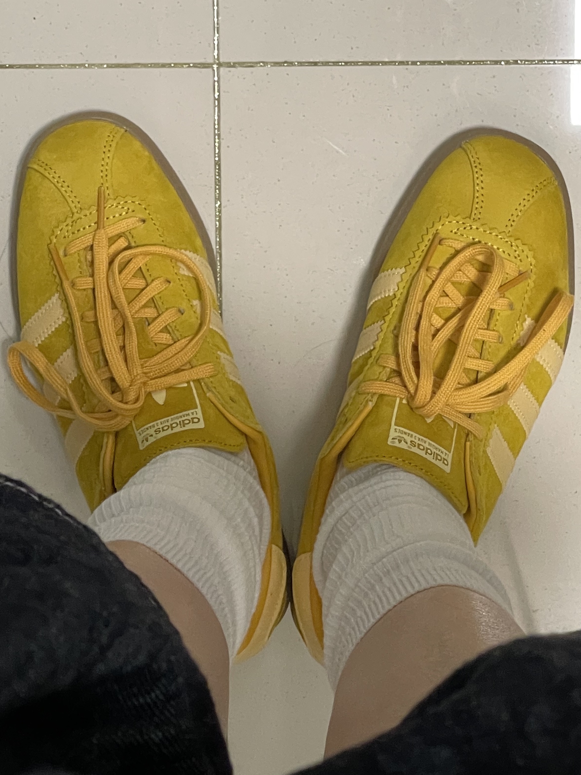 Adidas Bermuda Bold Gold 착용 스타일 - 3
