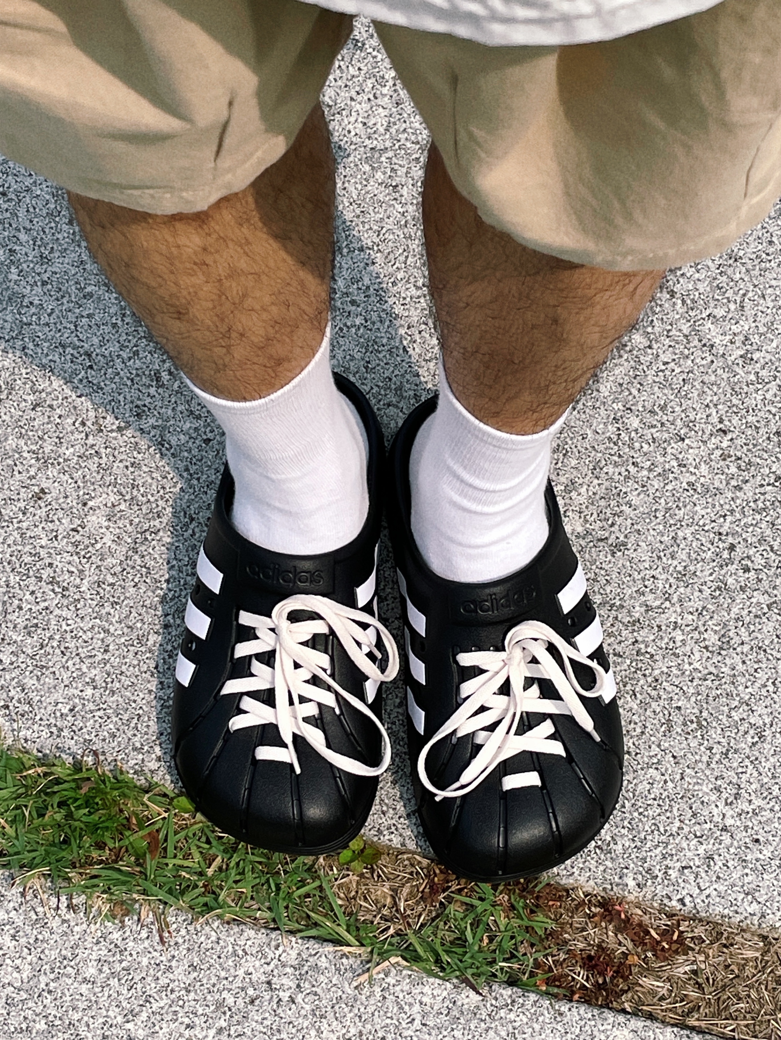 Adidas Adilette Clog Black White 착용 스타일 - 2