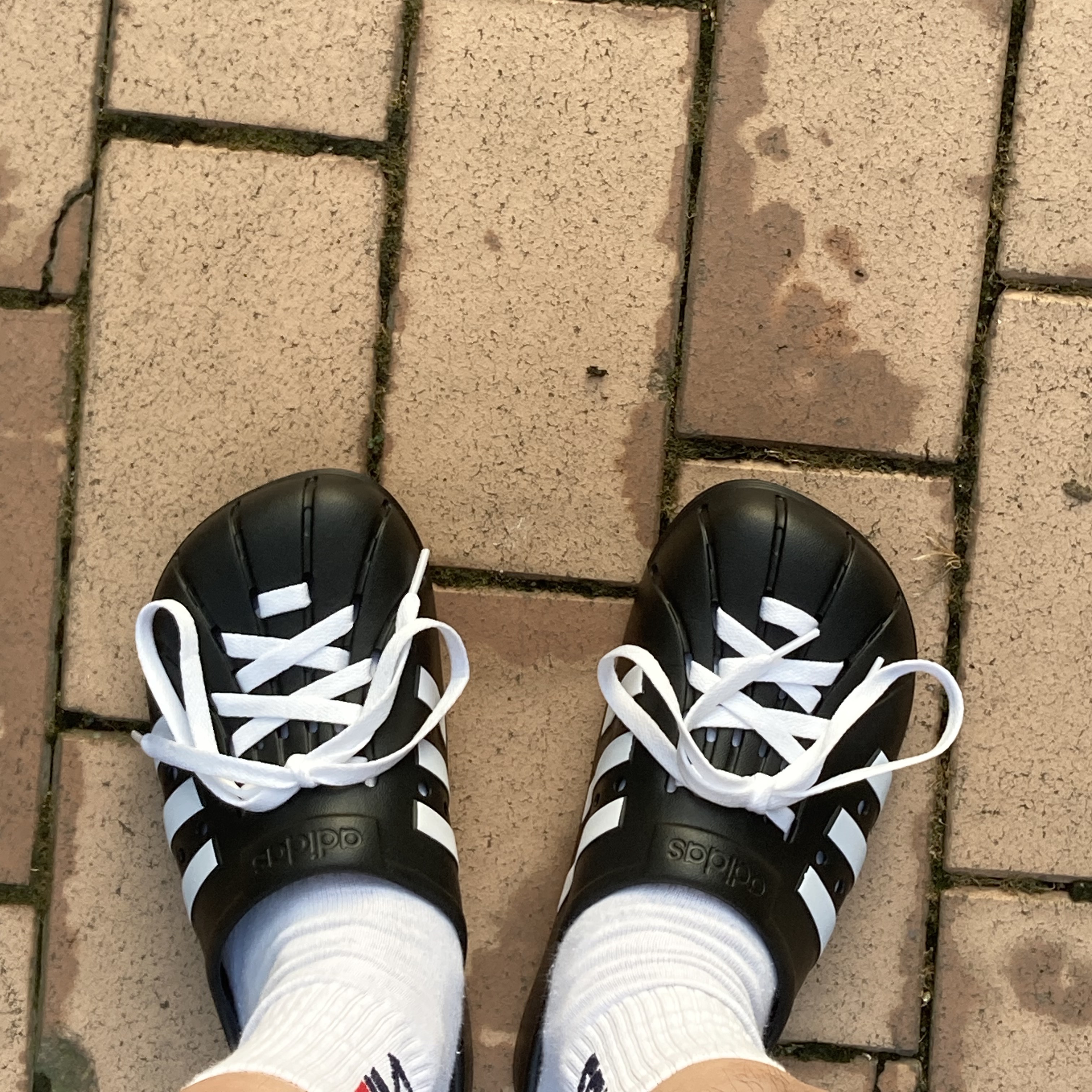 Adidas Adilette Clog Black White 착용 스타일
