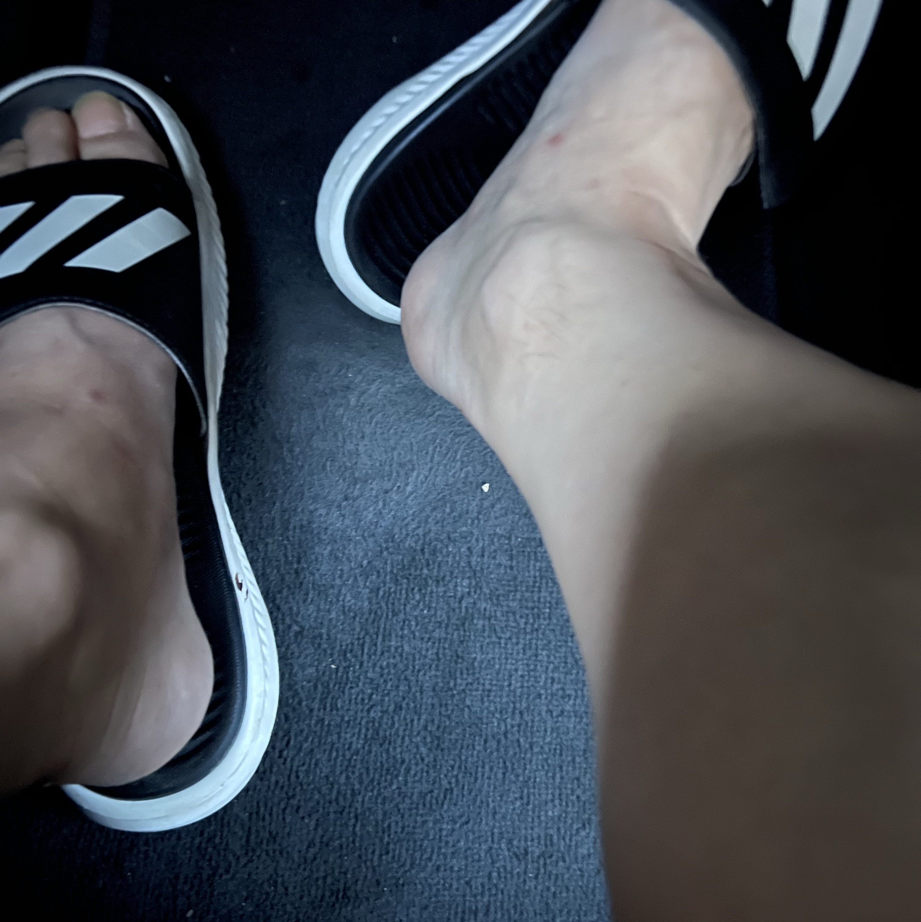 Adidas Alphabounce Slide Cloud White Core Black 착용 스타일