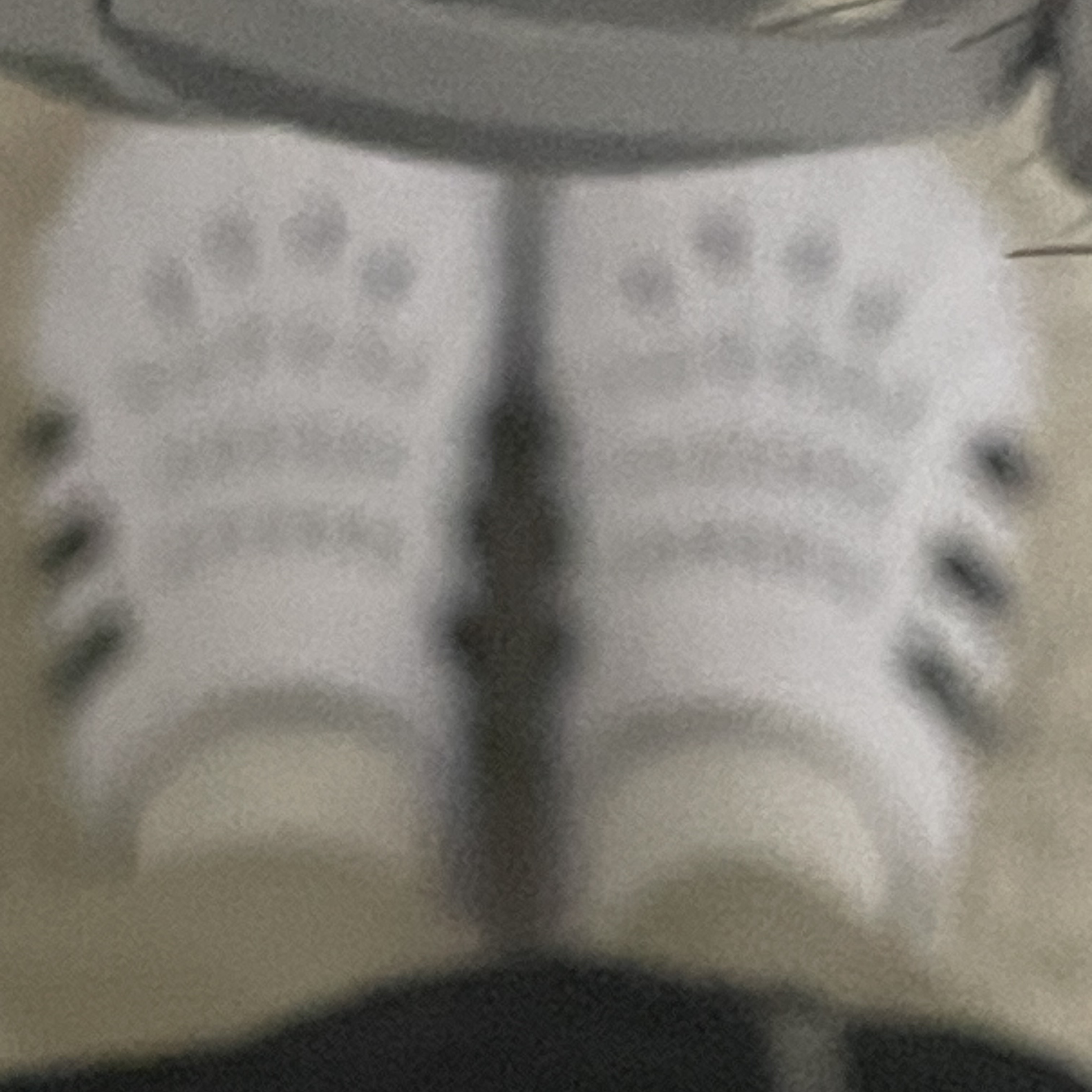 Adidas Adilette Clog White Black 착용 스타일 - 2