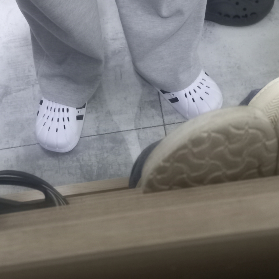 Adidas Adilette Clog White Black 착용 스타일 - 1