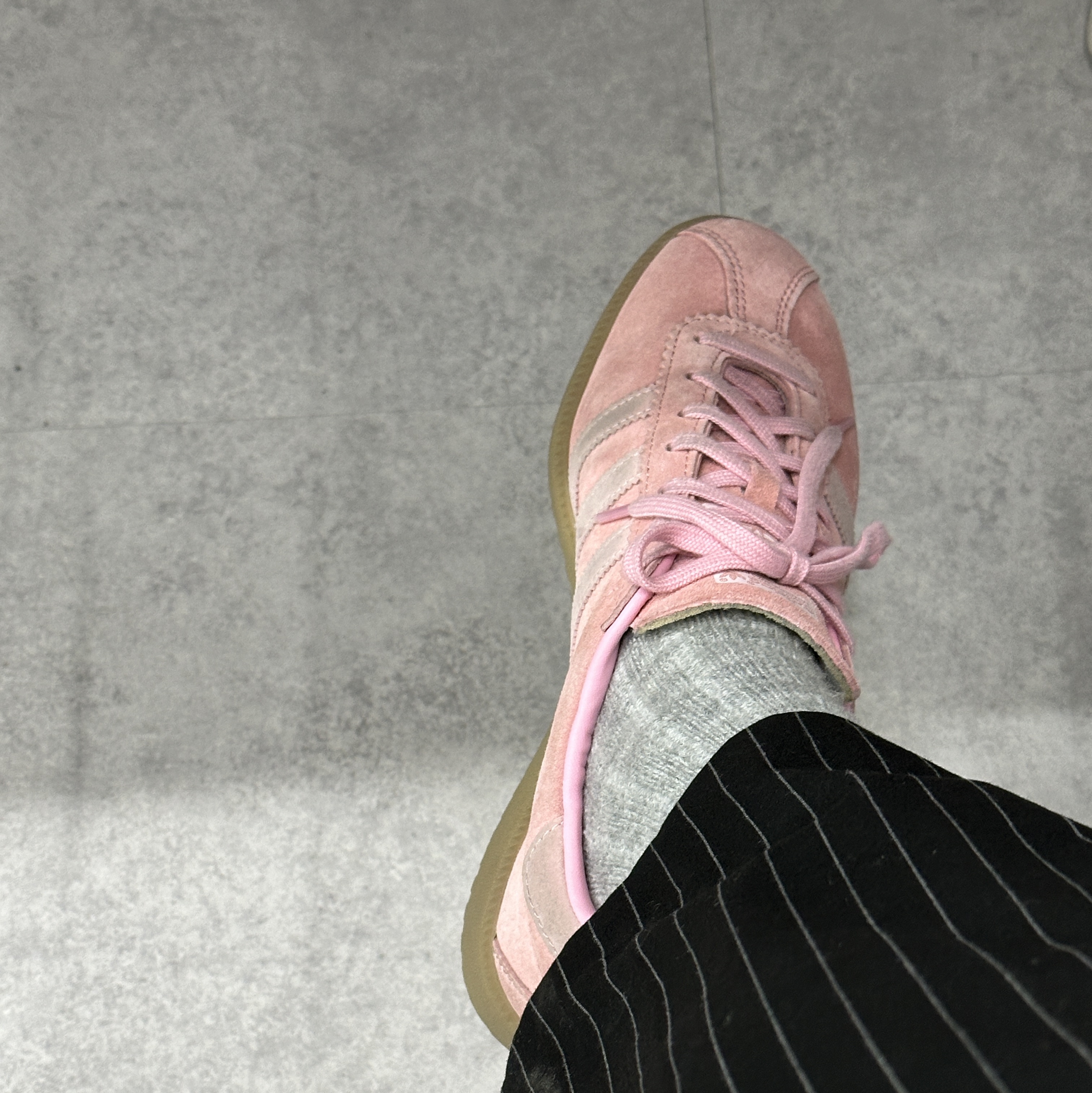 Adidas Bermuda Glow Pink 착용 스타일