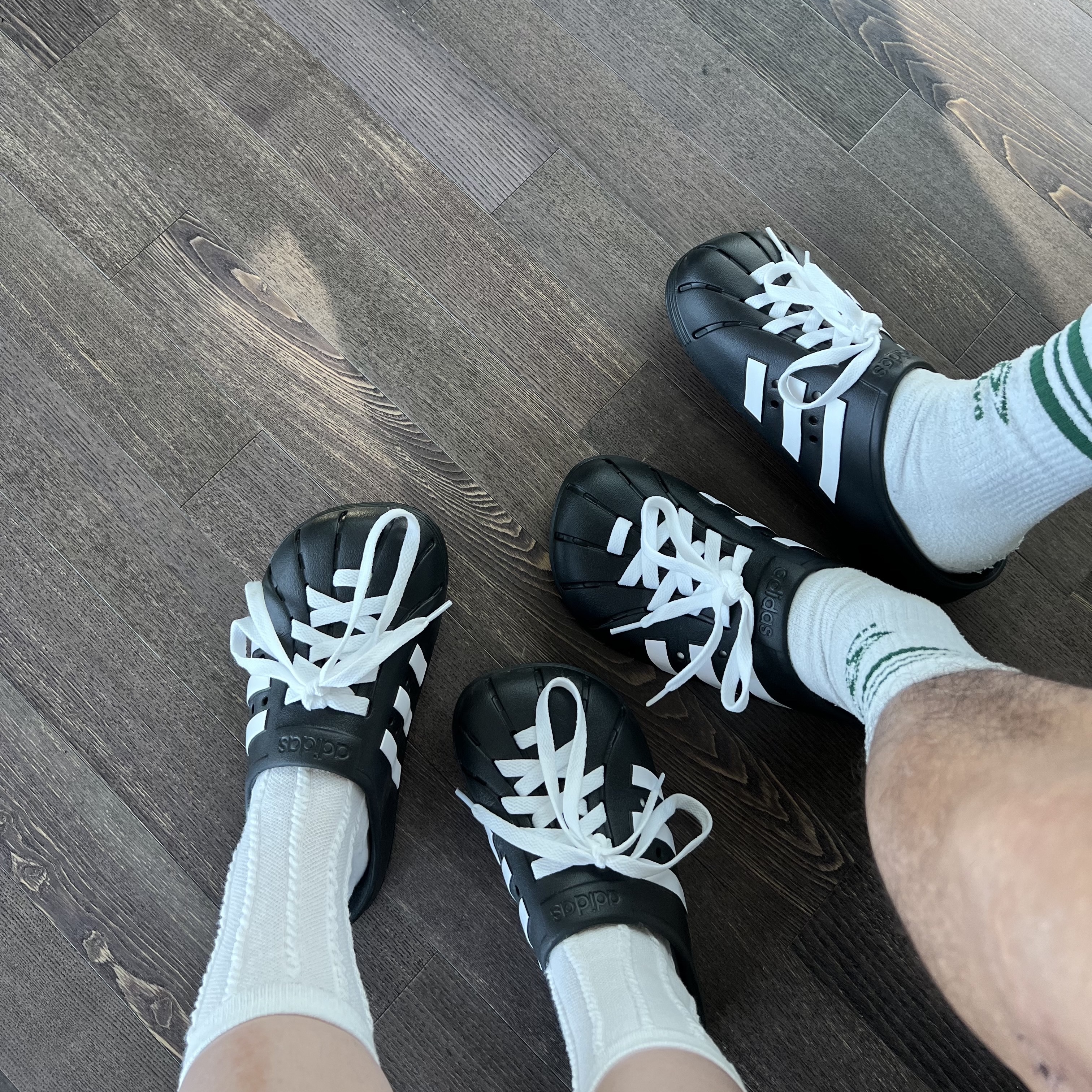 Adidas Adilette Clog Black White 착용 스타일