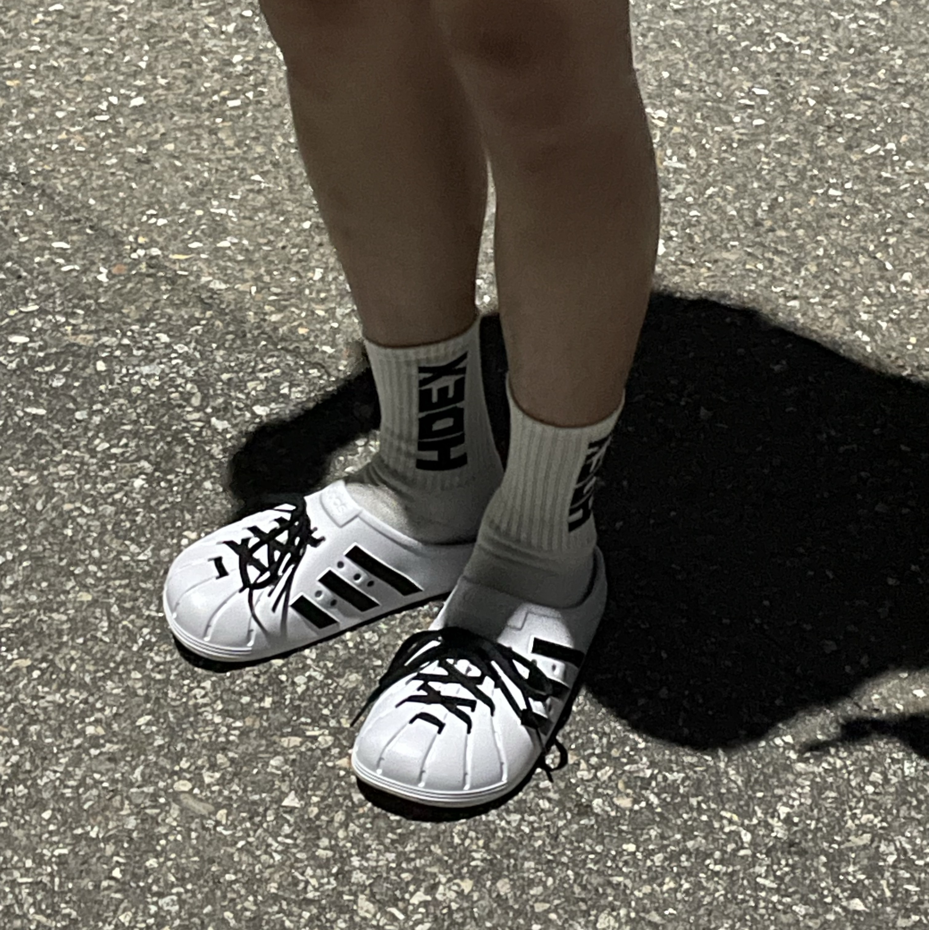 Adidas Adilette Clog White Black 착용 스타일 - 2