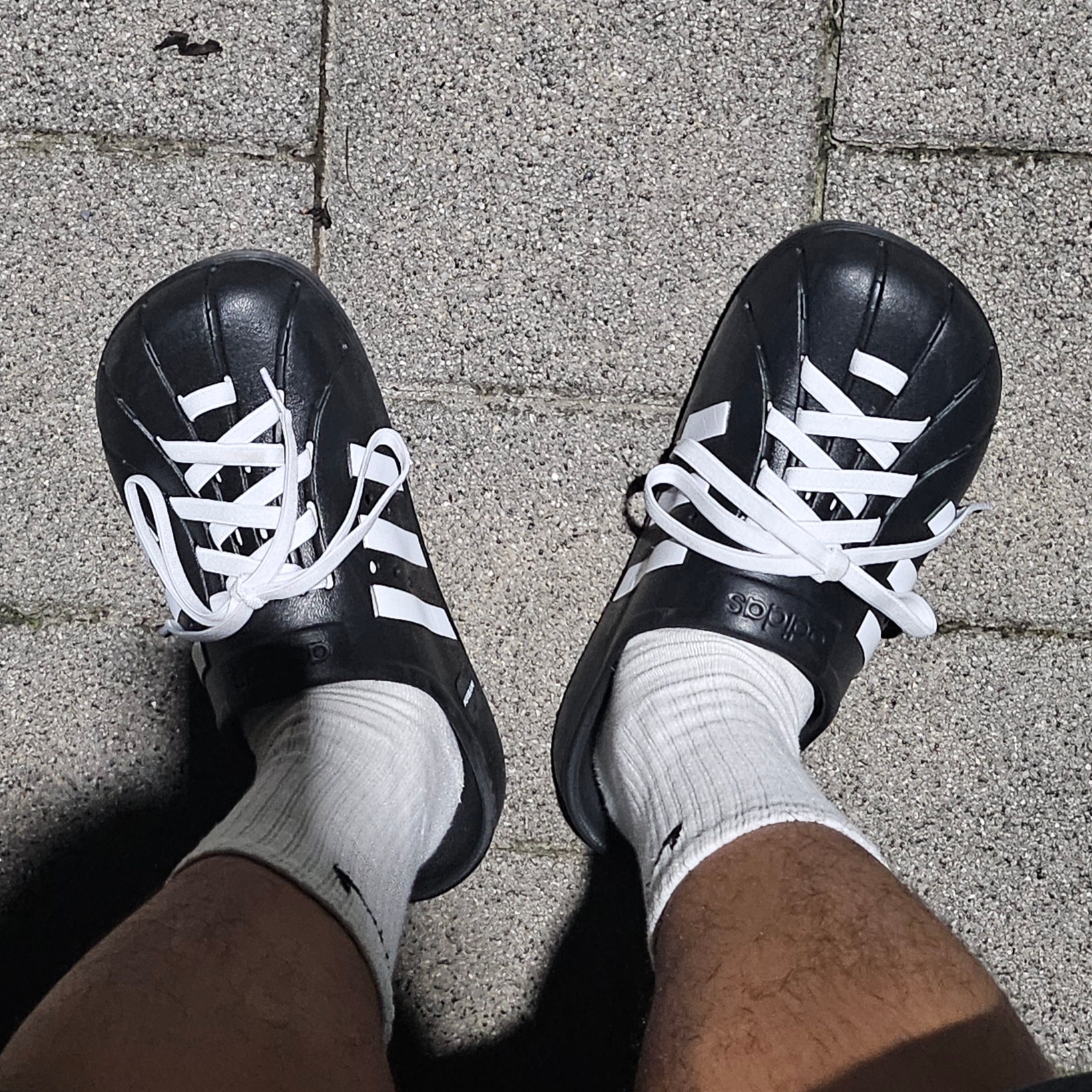 Adidas Adilette Clog Black White 착용 스타일