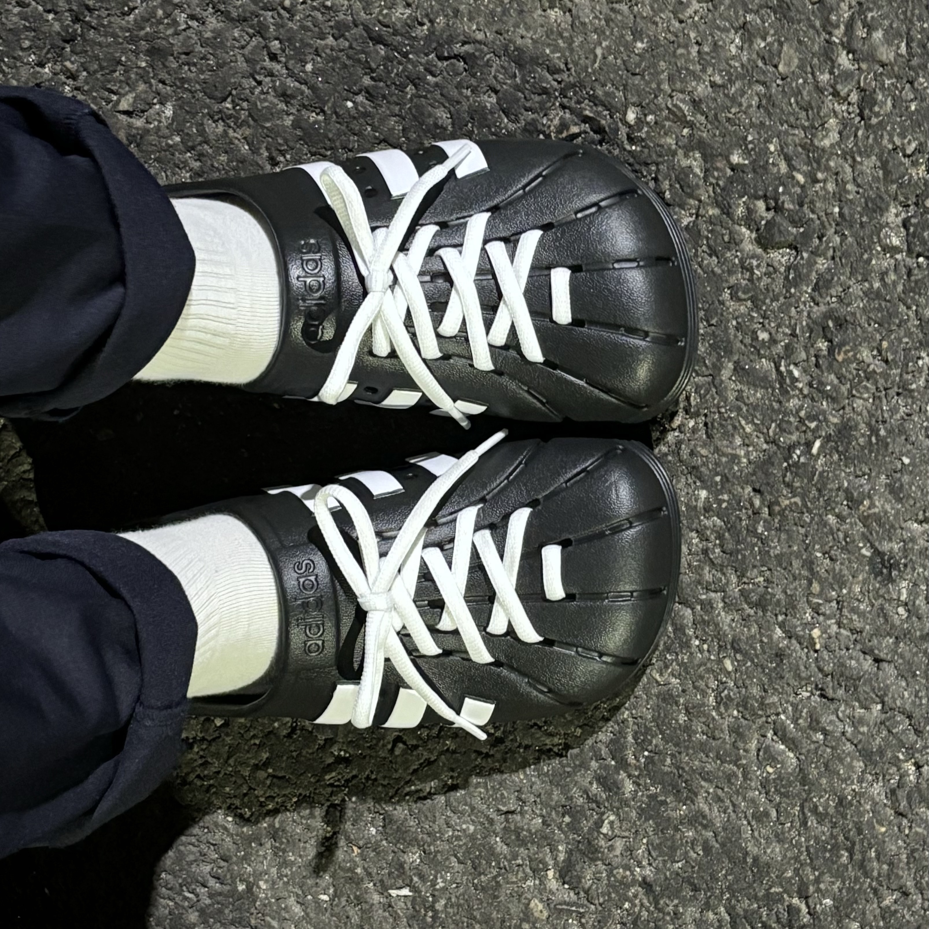 Adidas Adilette Clog Black White 착용 스타일