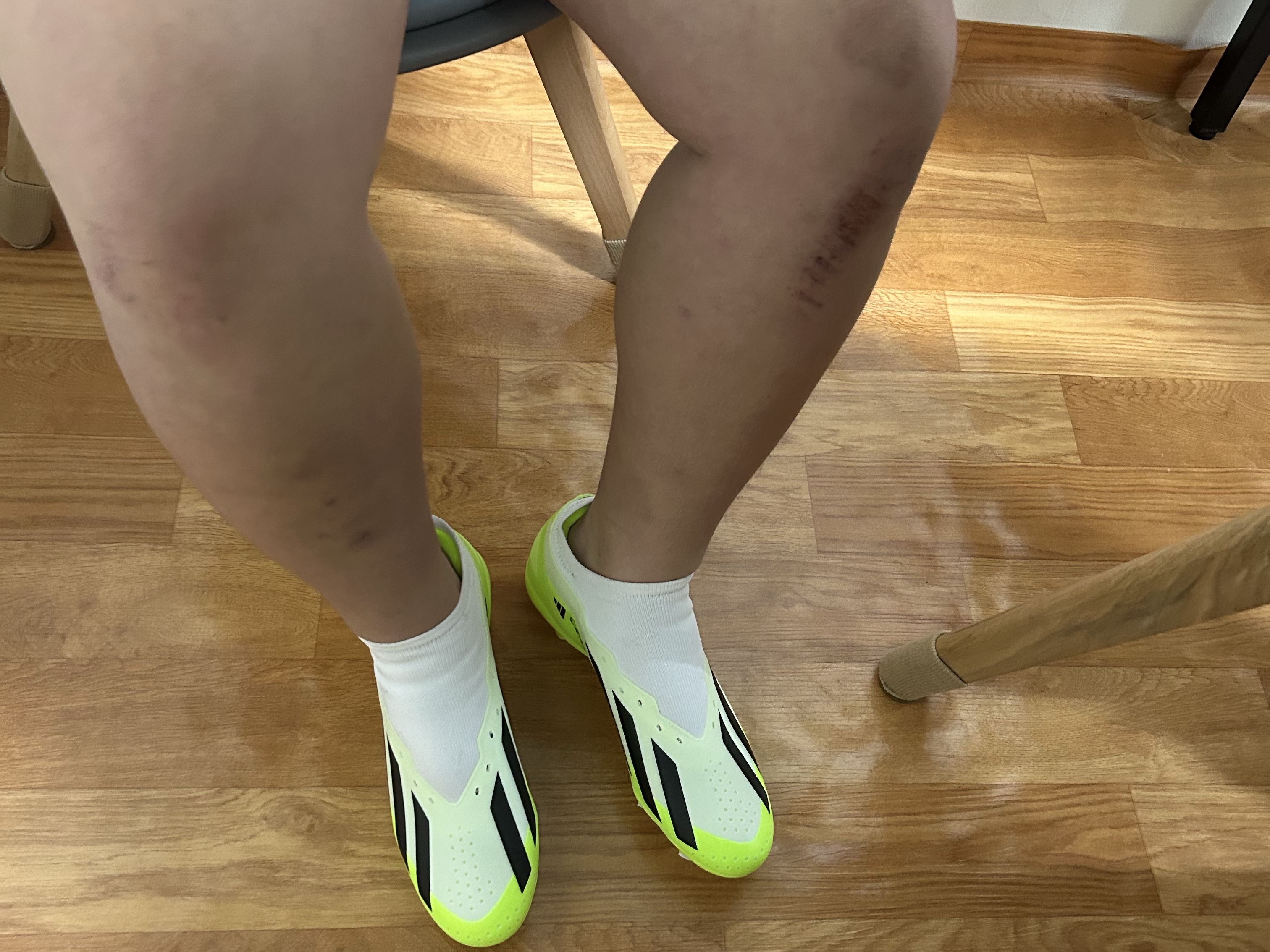 Adidas X Crazyfast.3 FG Cloud White Lucid Lemon 착용 스타일