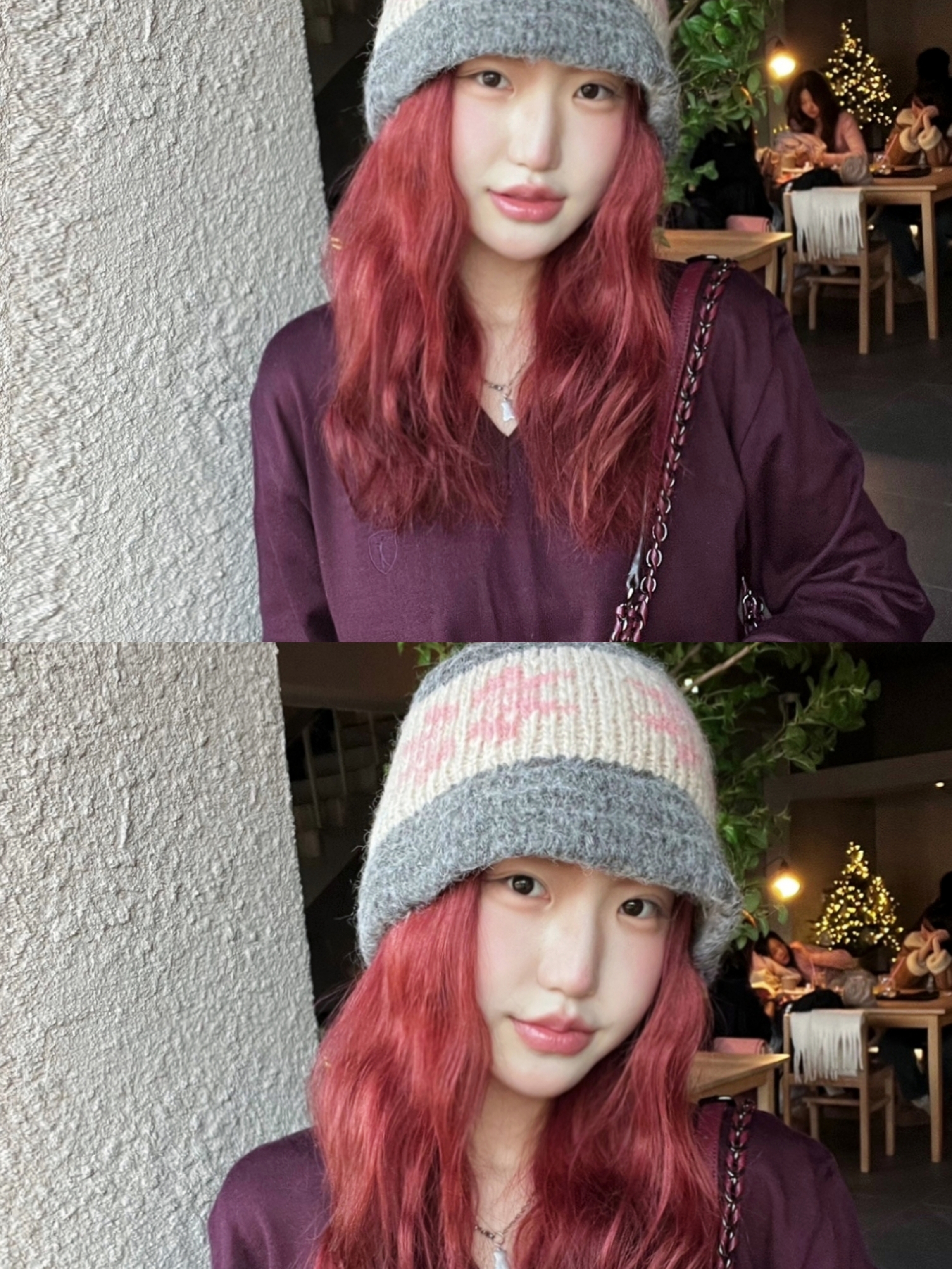 Adidas Bermuda Glow Pink 착용 스타일 - 2