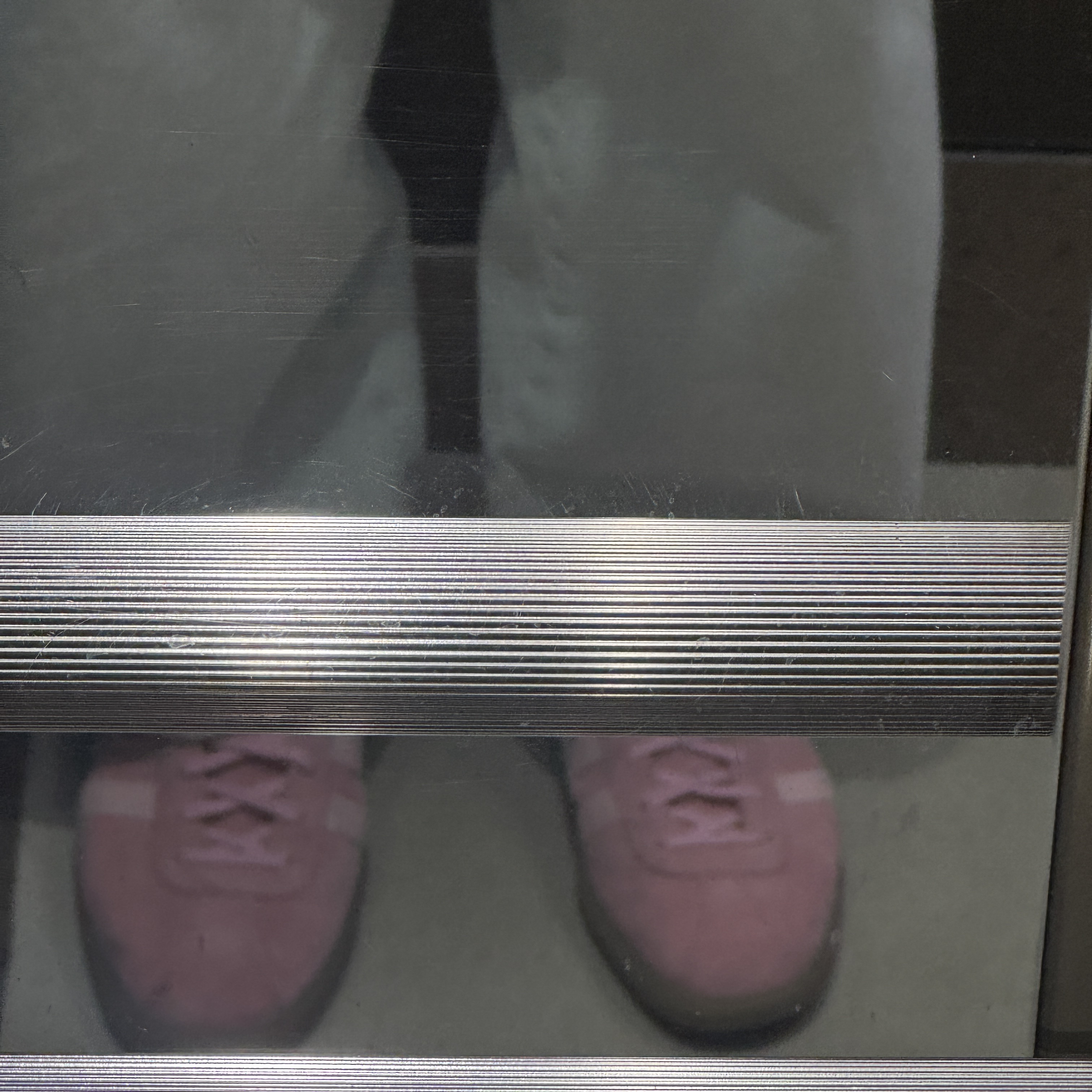 Adidas Bermuda Glow Pink 착용 스타일