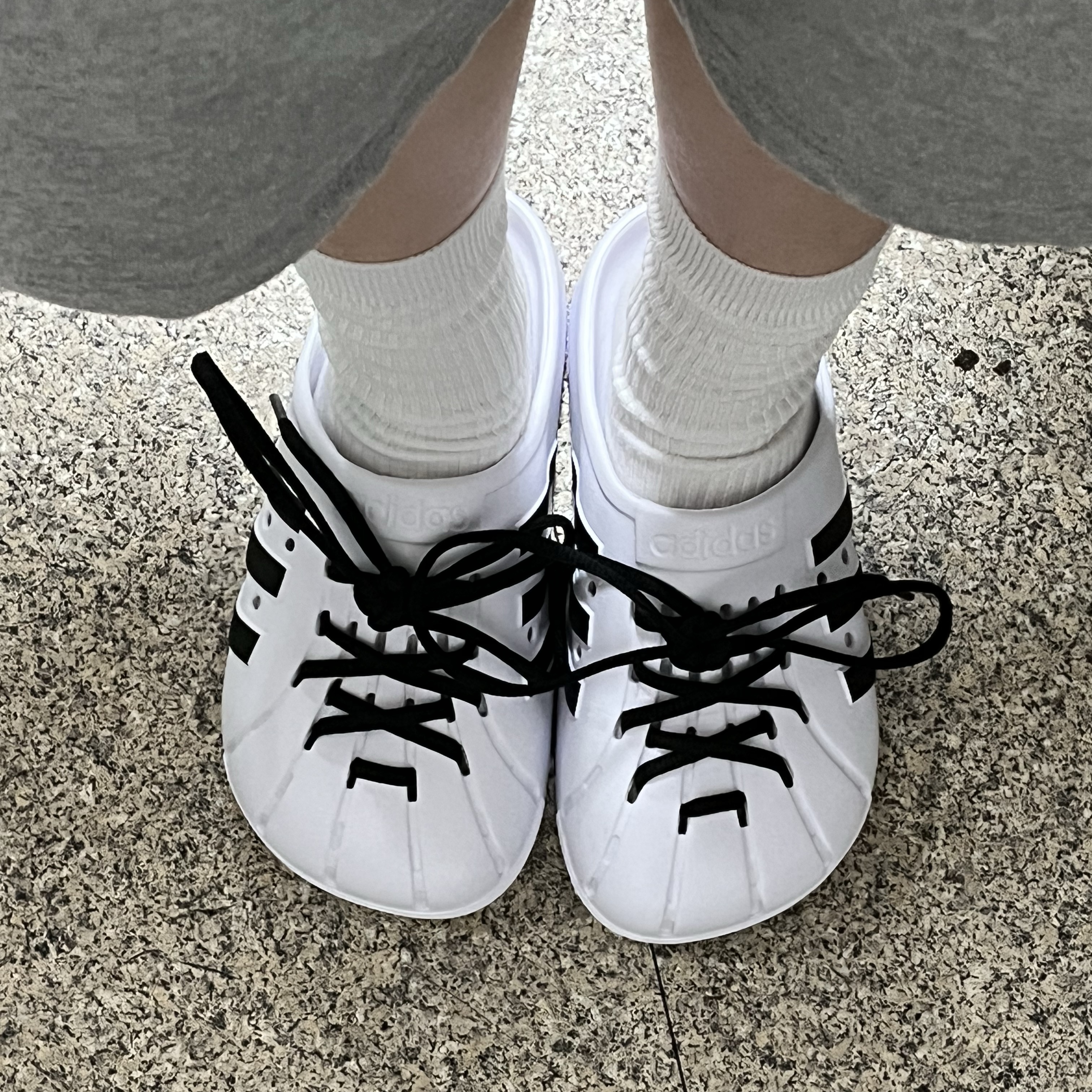 Adidas Adilette Clog White Black 착용 스타일