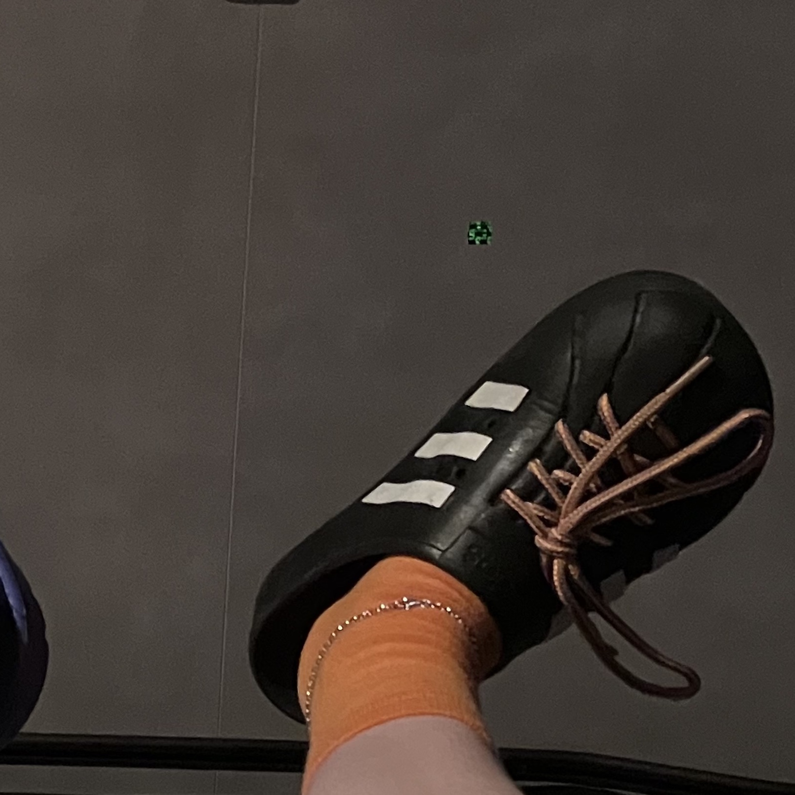 Adidas Adilette Clog Black White 착용 스타일 - 4