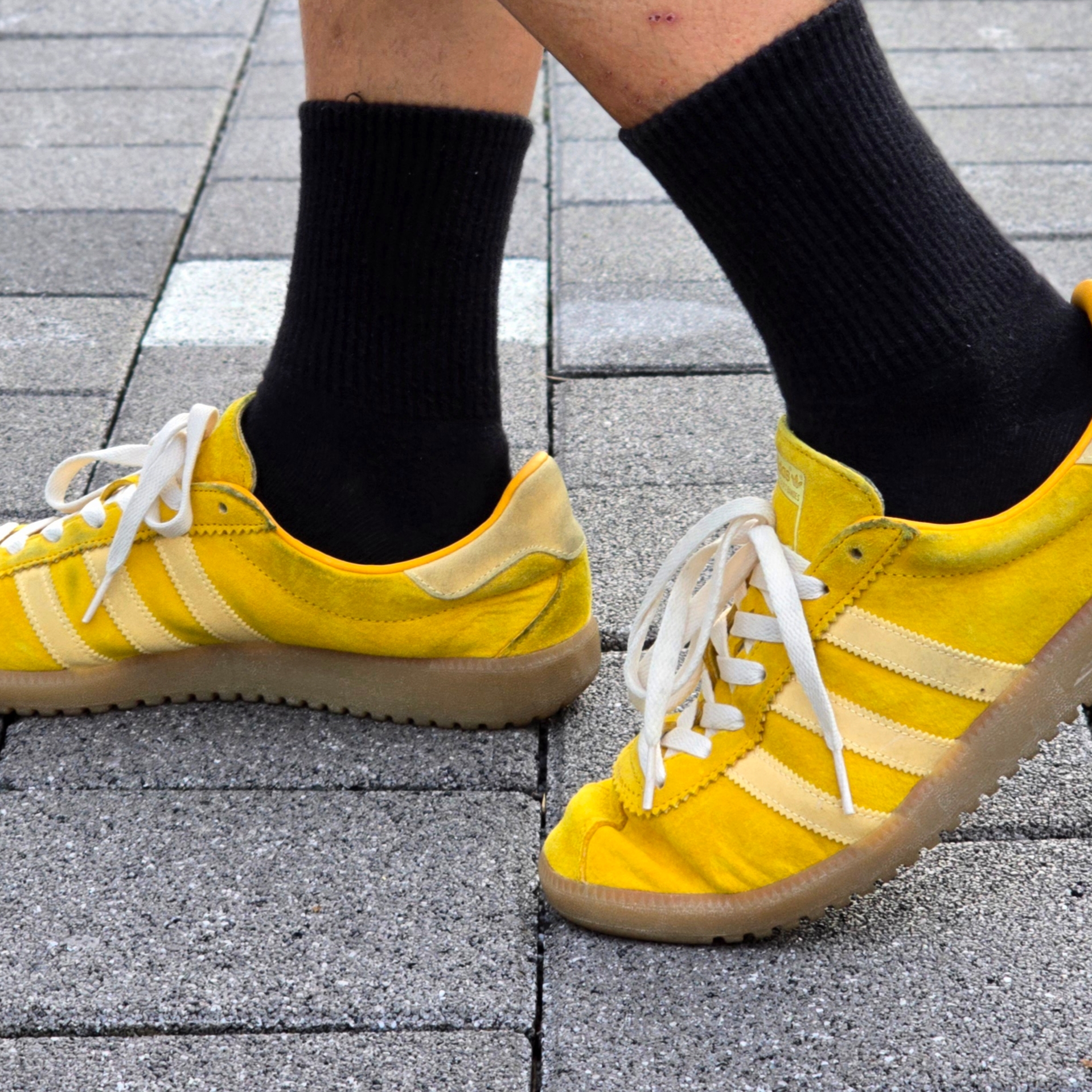 Adidas Bermuda Bold Gold 착용 스타일
