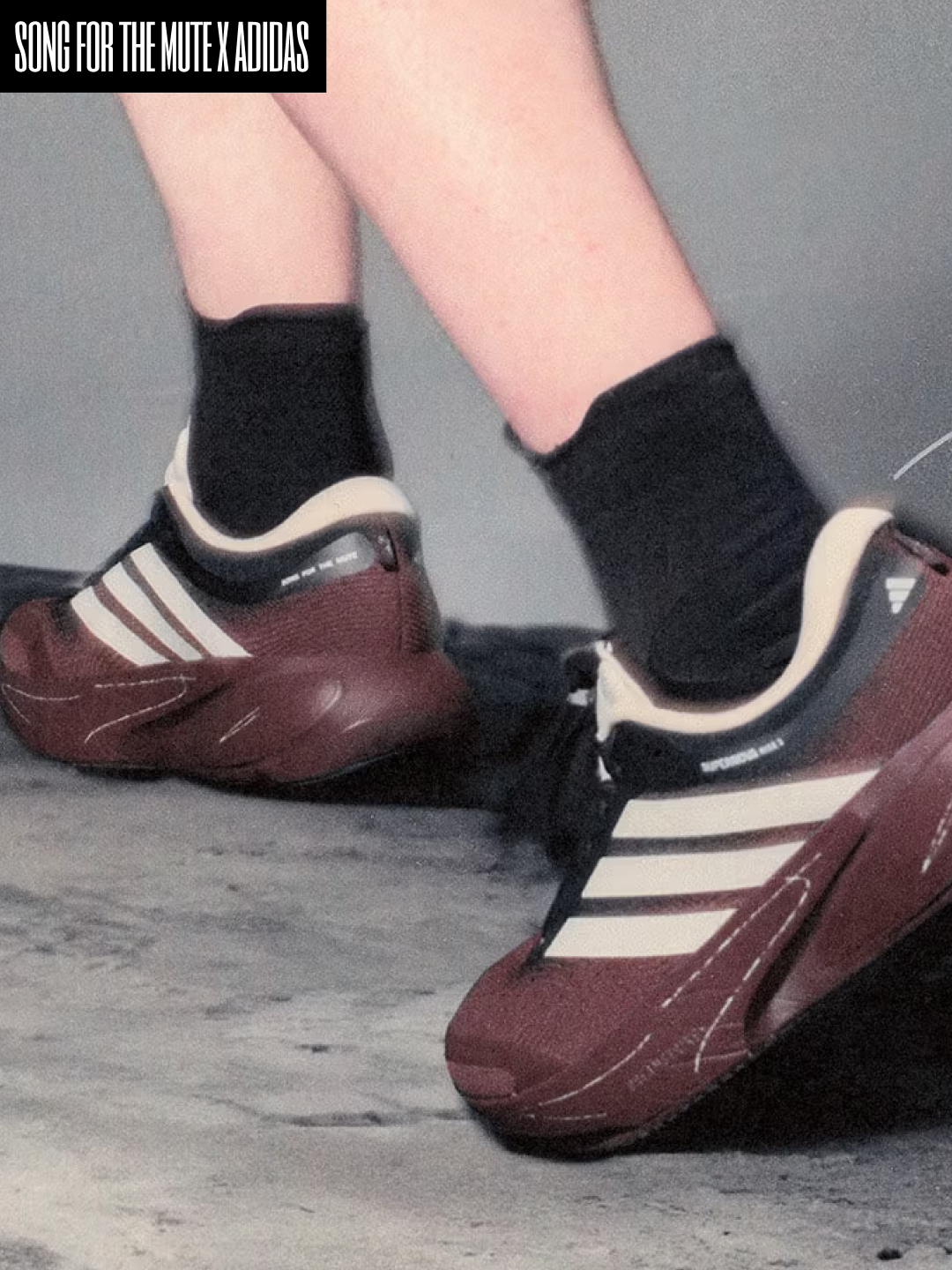 (W) Adidas x Song for the Mute Supernova Rise 3 Off White Core Black, Adidas x Song for the Mute Supernova Rise 3 Auburn Chalk White 착용 스타일 - 2