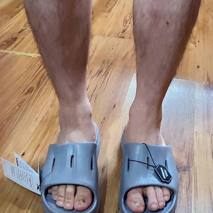 Hoka Ora Recovery Slide 3 Grey 착용 스타일
